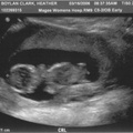 Abigail's Ultrasound